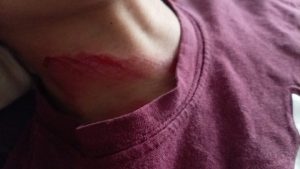 Preocupa a vecinos de Ex Hacienda las agresiones de perros